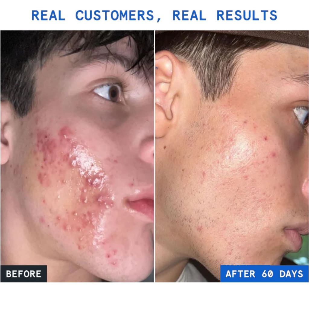 GHK-Cu Peptide Serum